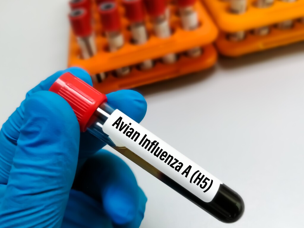 Teste de gripe aviária